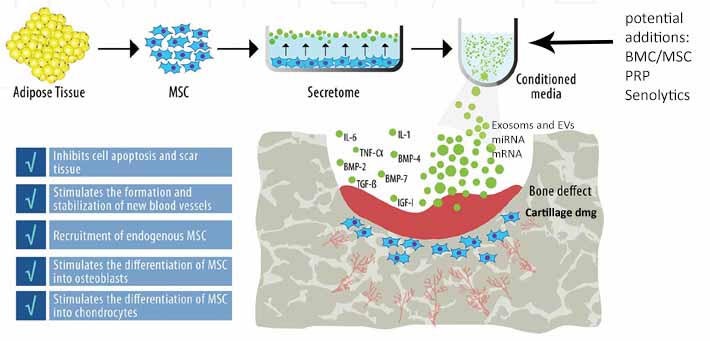 Anova Stem Cell Exosome EV apraoch Anova Stem Cell Exosome EV apraoch