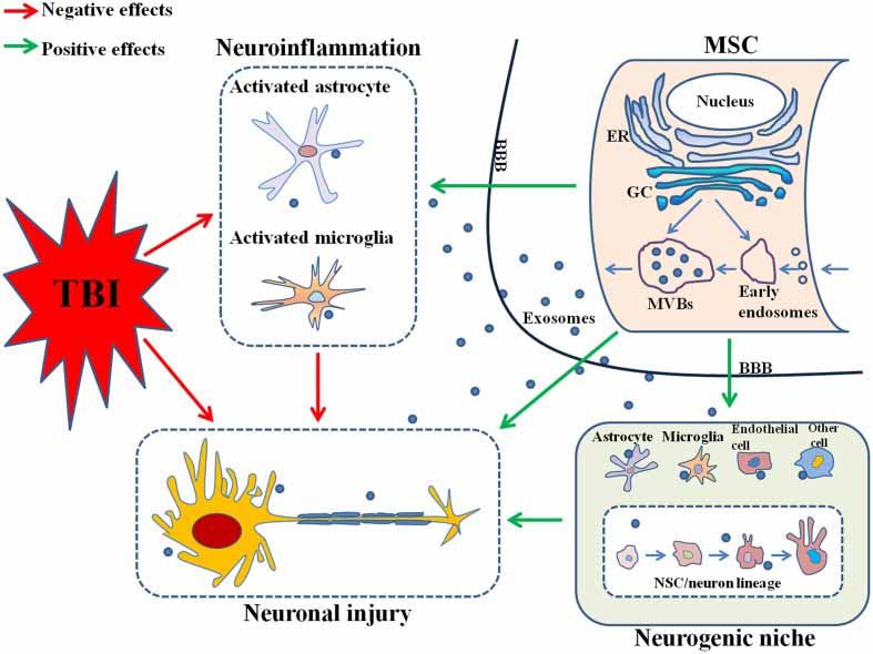 Neurodegeneration Traumatic Brain Injuri effects of exosomes Neurodegeneration Traumatic Brain Injuri effects of exosomes