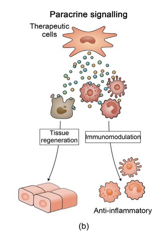 Paracrine signaling from mesenchymal stem cells releases healing agents that help regulate inflammation and support tissue response in orthopedic conditions. Source: Adapted from Aitbenkaddour et al., 2023, Wikimedia Commons (CC BY 4.0) Required Links “Wikimedia Commons” → https://commons.wikimedia.org/wiki/File:Potential_mechanisms_of_cell_therapy.jpg “CC BY 4.0” → https://creativecommons.org/licenses/by/4.0/ stem cell therapy for orthopedic injuries diagram showing paracrine signaling and anti-inflammatory effects.