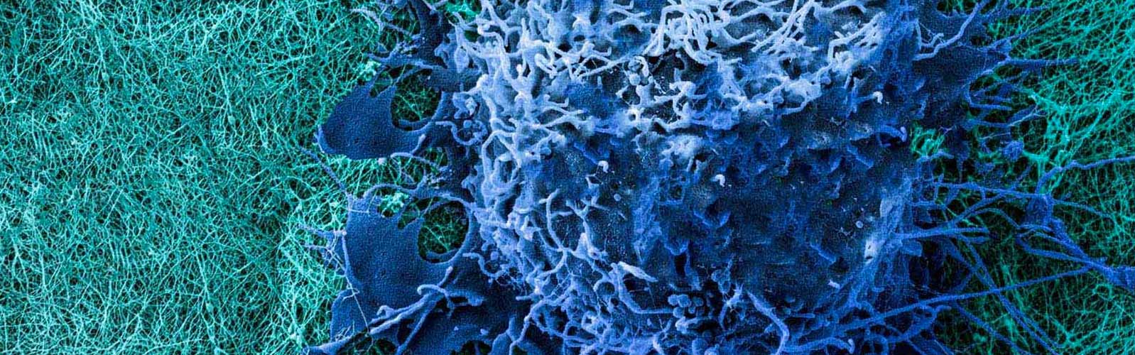 anova institute for regenerative medicine - bone marrow concentrate bmc