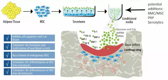Anova Stem Cell Exosome EV apraoch Anova Stem Cell Exosome EV apraoch