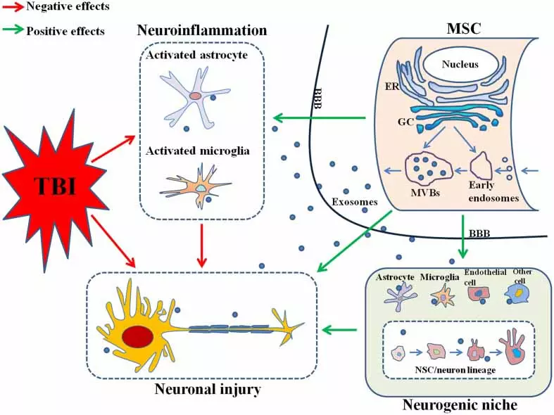 Neurodegeneration Traumatic Brain Injuri effects of exosomes Neurodegeneration Traumatic Brain Injuri effects of exosomes