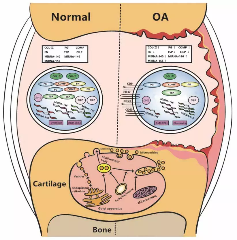 OA changes in Cartilage and Joint OA changes in Cartilage and Joint