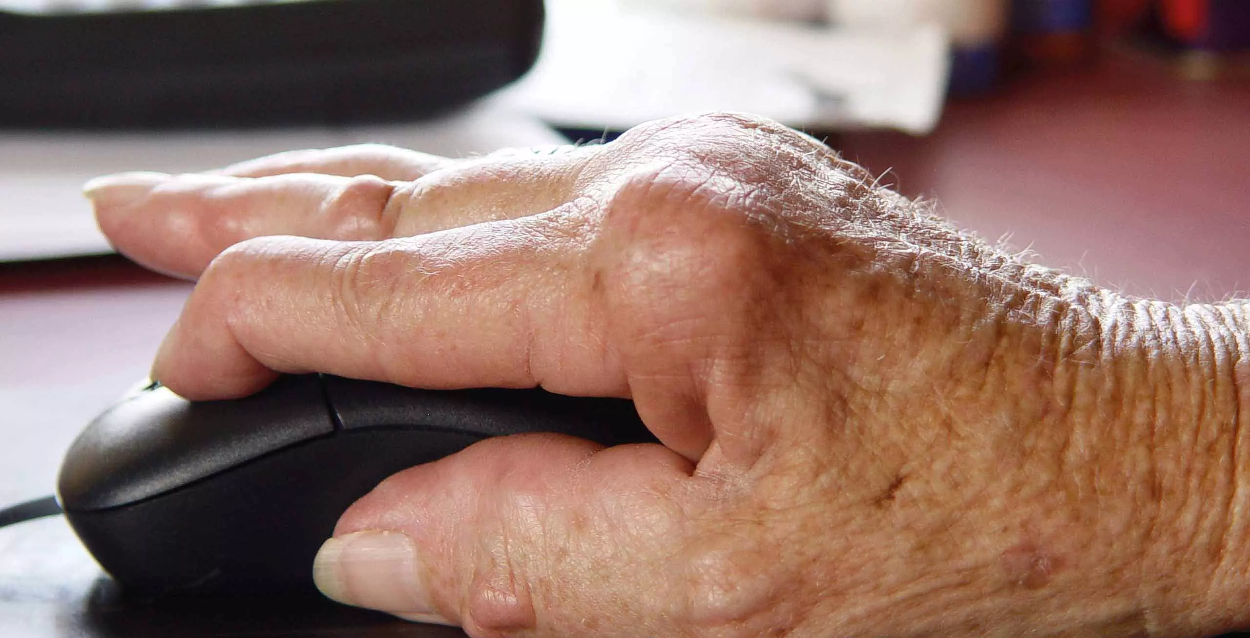 hand on Mouse Rheuma hand on mouse