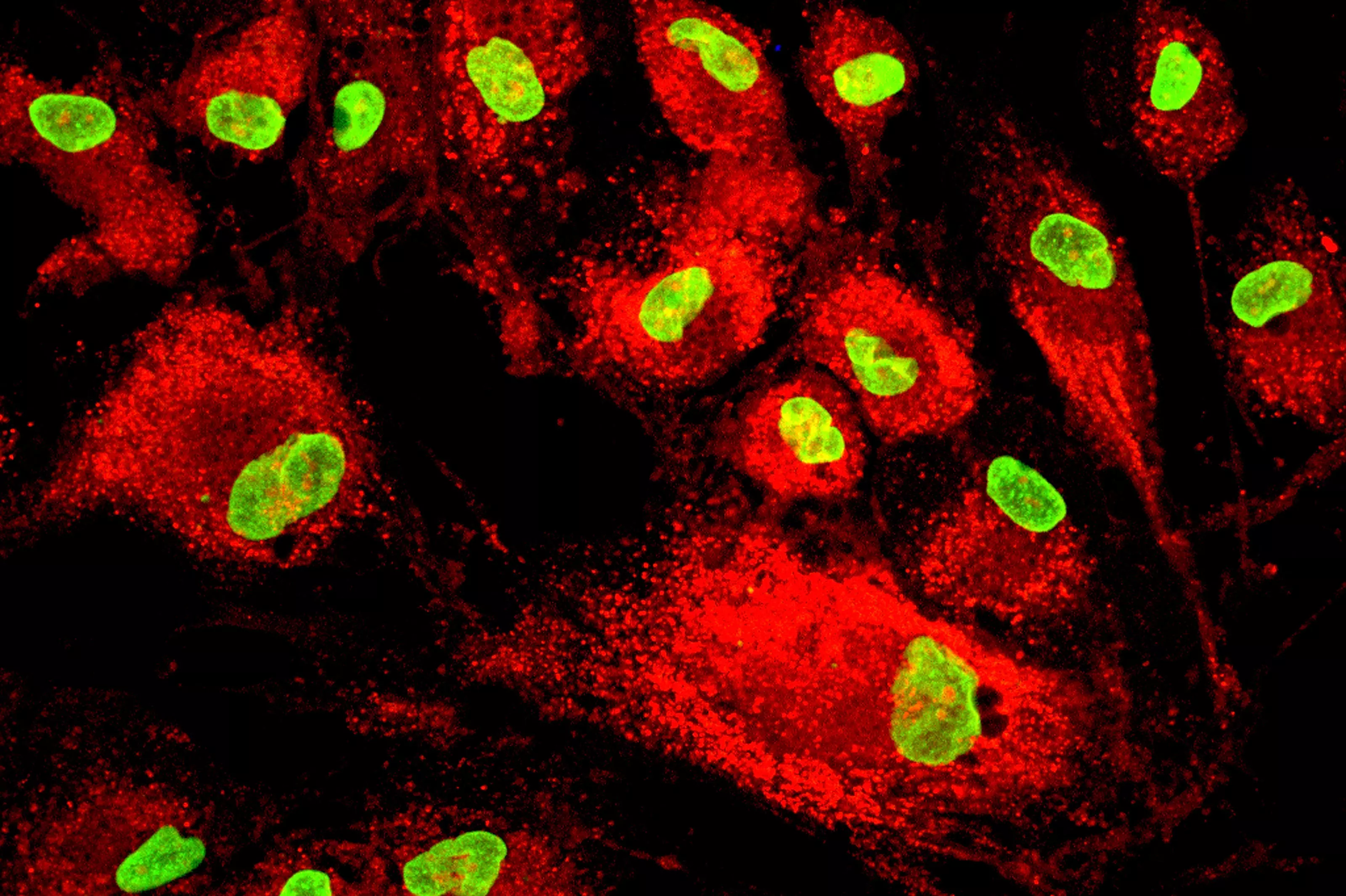 MSC mesenchymal stem cell flourecent microscope image wide MSC mesenchymal stem cell flourecent microscope image wide