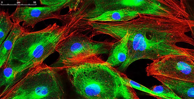 ANOVA IRM Deutschland - Immunfluoreszenzfärbung von Zellen