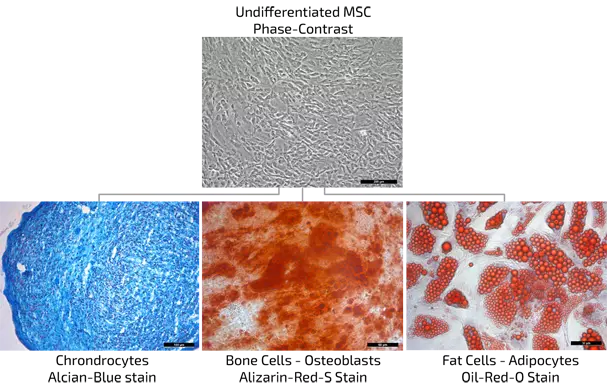 ANOVA IRM Germany MSC mesenchymal stem cell differentiation ANOVA IRM Germany MSC mesenchymal stem cell differentiation