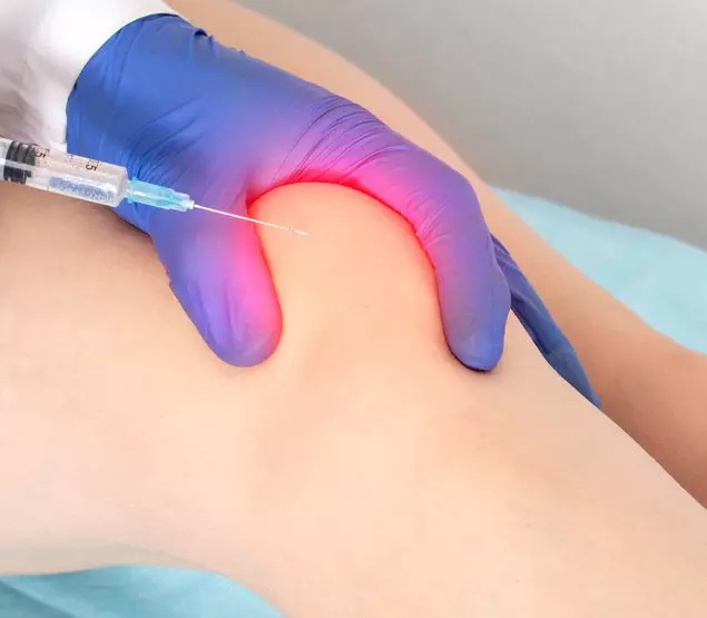 CT-assisted stem cell injection into joints CT-assisted stem cell injection into joints | ANOVA