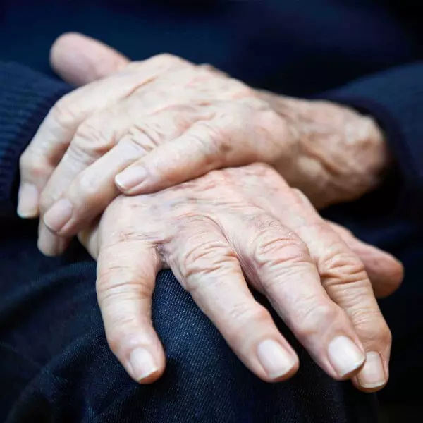 Parkinson