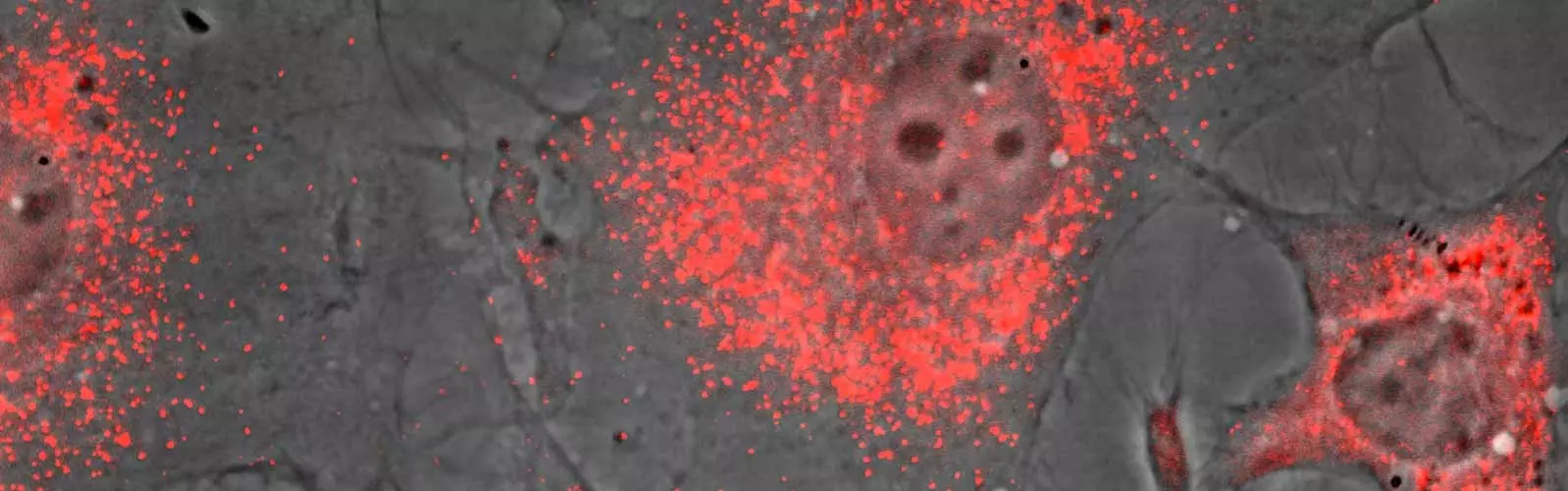 anova institute for regenerative medicine - the power of exosomes