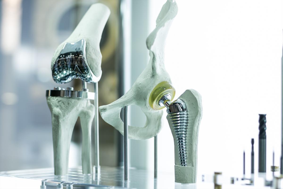 Artificial joint implants for knee and hip replacement when osteoarthritis causes severe pain in weight-bearing joints